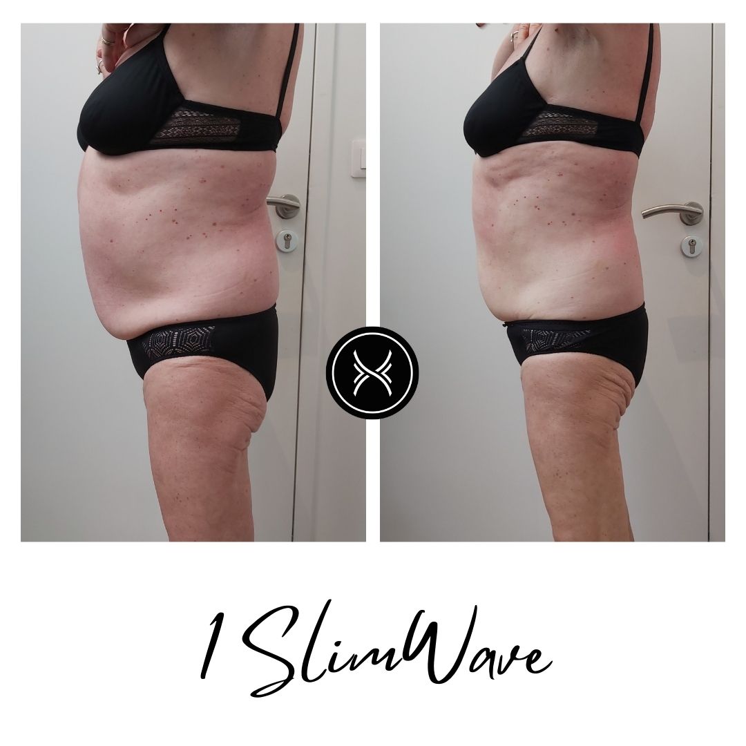 Resultat-Slimwave-1