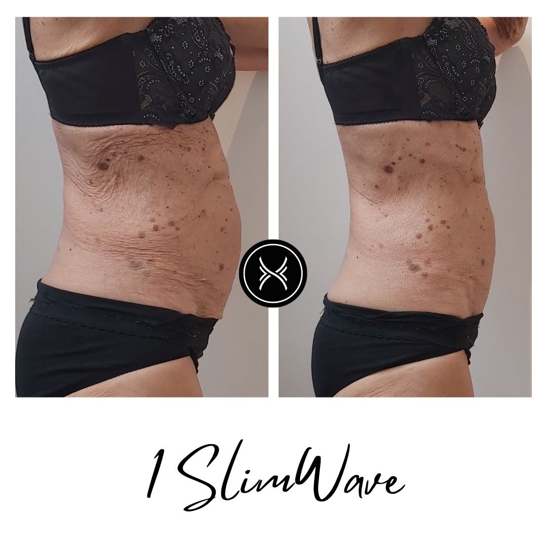 Resultat-Slimwave-3