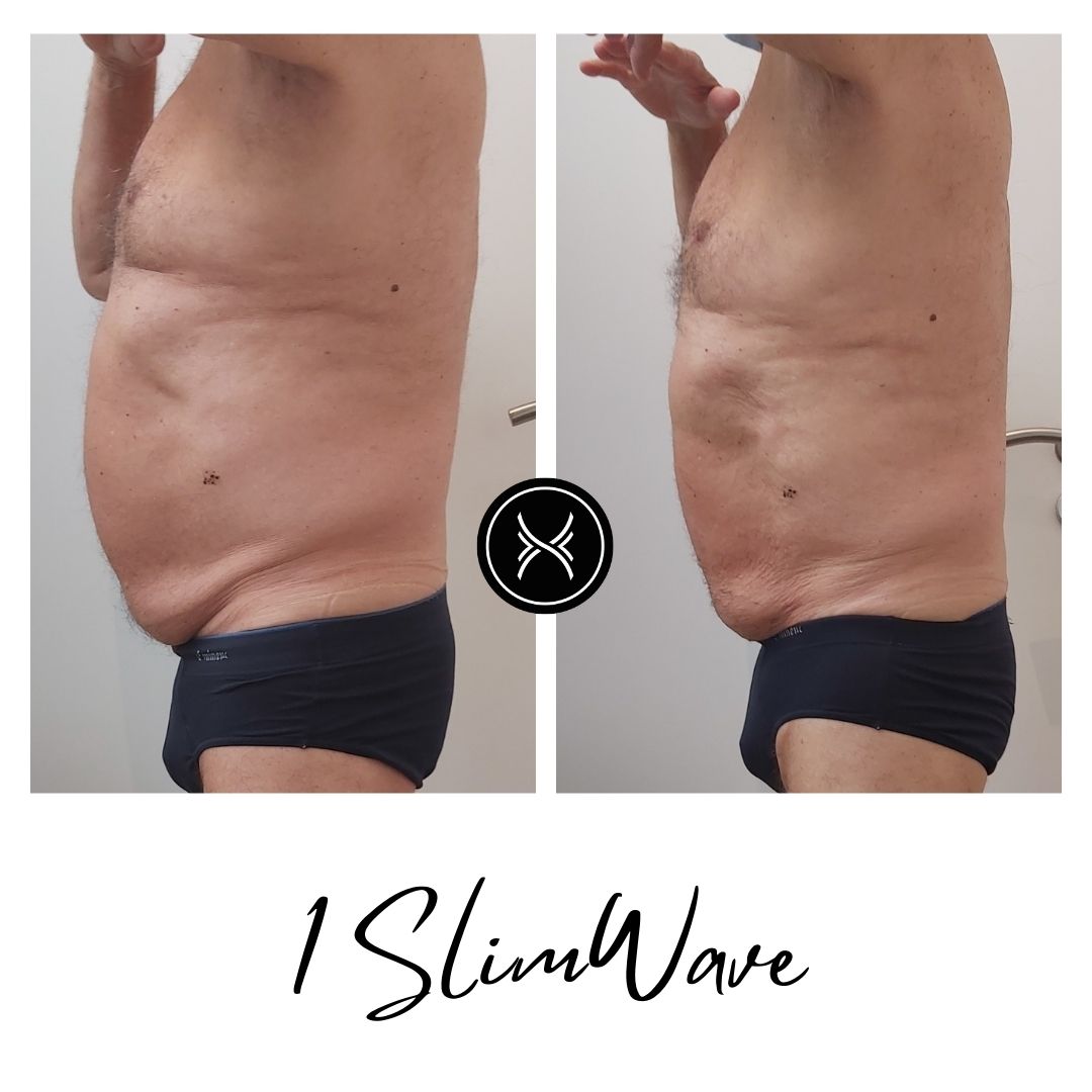 Resultat-Slimwave-4