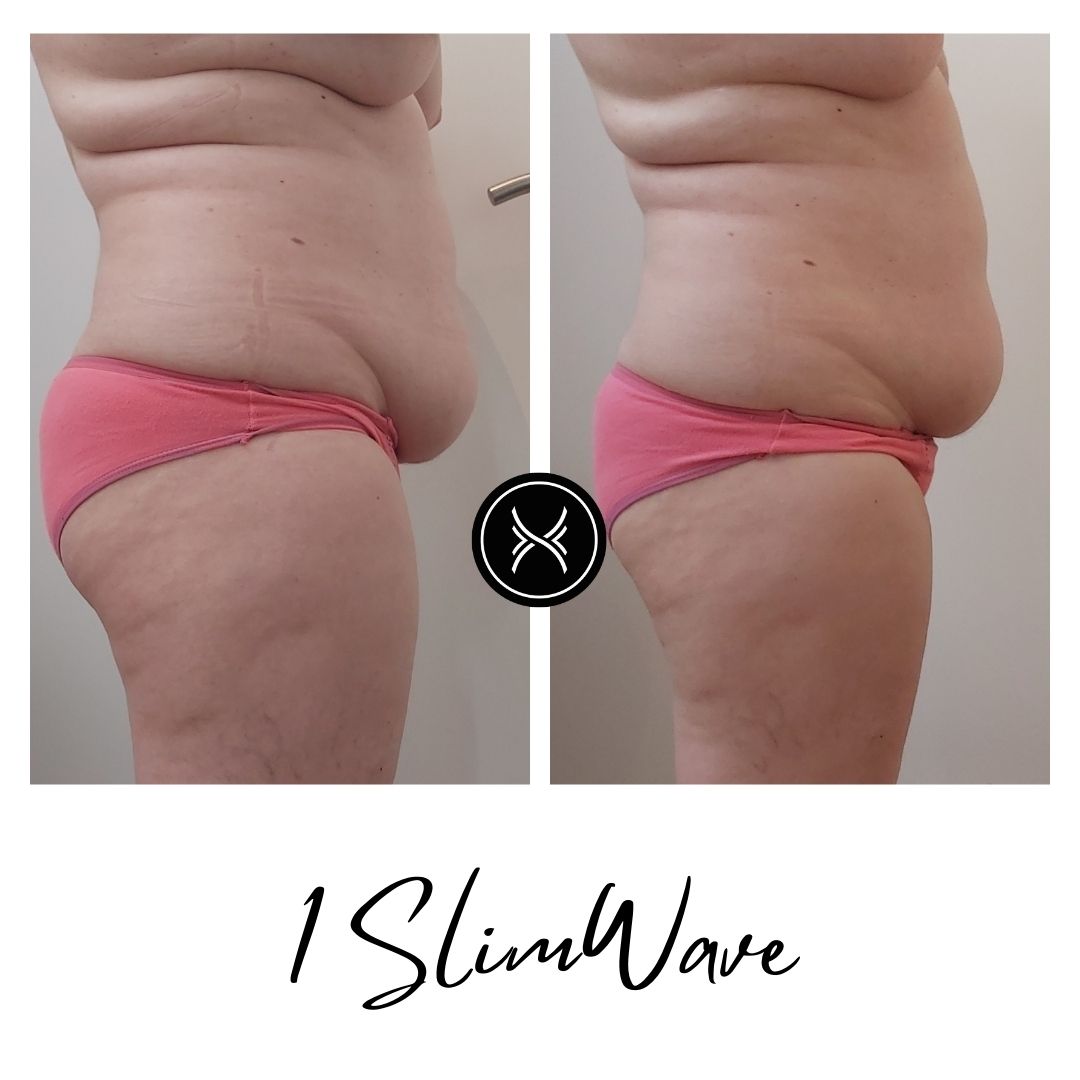 Resultat-Slimwave-9